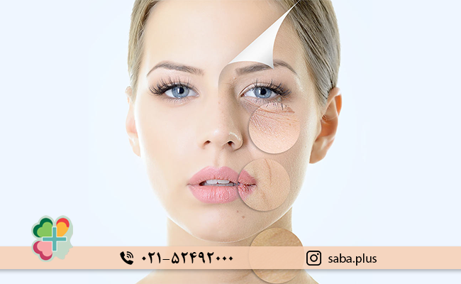 دلایل-پیری-و-چین-و-چروک-روی-پوست