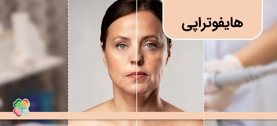 هایفوتراپی