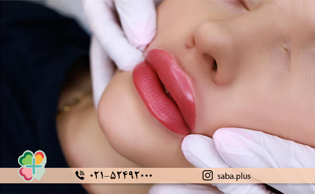مزایای تزریق ژل لب مدل عروسکی