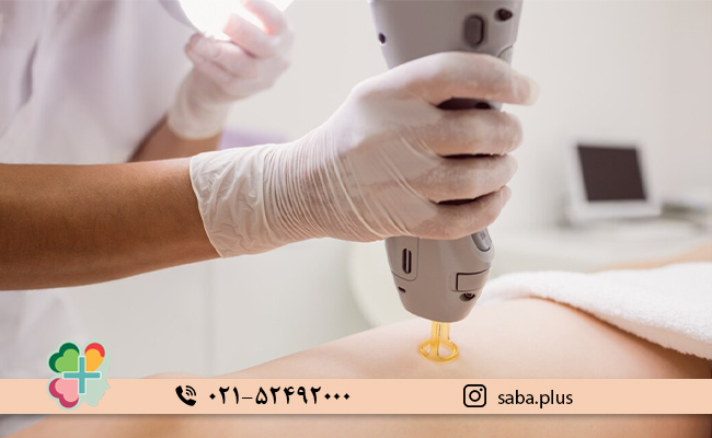 آیا-لیزر-بیکینی-بی_خطر-است؟