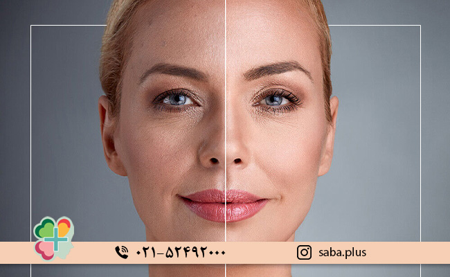 به-حذف-چربی-در-نقاط-مختلف-بدن-کمک-می_کند