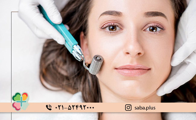 میکرونیدلینگ-چیست؟