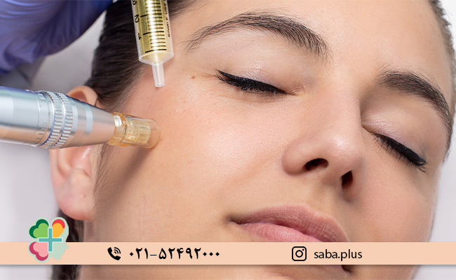 تفاوت-مزوتراپی-و-میکرونیدلینگ-در-درمان-مشکلات-پوستی