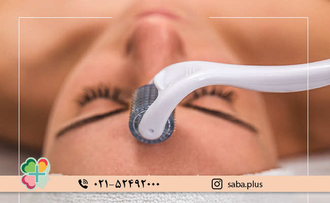 تفاوت-مزوتراپی-و-میکرونیدلینگ-در-نحوه-مصرف-و-اندازه-سوزن