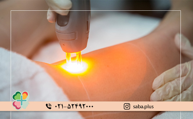 عمق-نفوذ-لیزر-در-پوست-چقدر-است؟