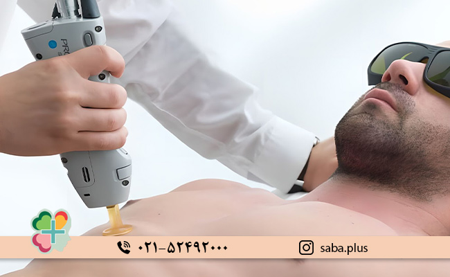 عوارض-لیزر-موهای-زائد-در-آقایان