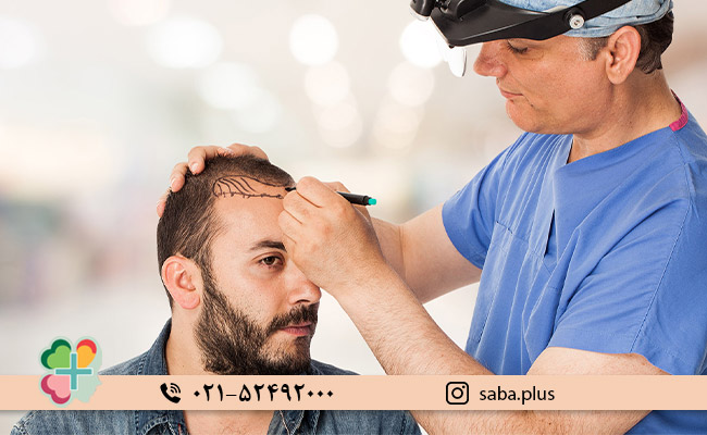 بهترین-درمان-ریزش-مو-چیست؟