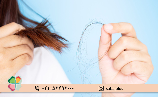 ریزش-مو-چقدر-طبیعی-است؟